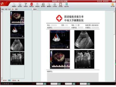 北京超聲醫學影像工作站