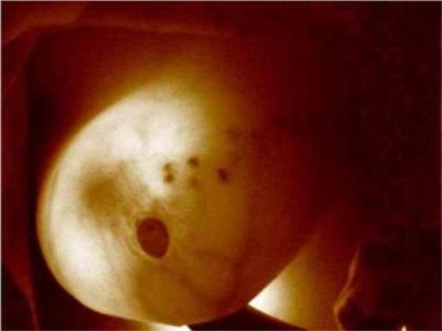 广州红外乳腺影像系统